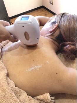 マイビューティー 箕輪店(MyBeauty)/全身脱毛：背中