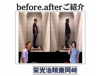 栄光治院 整体院東岡崎/姿勢が悪いとみっともない。。