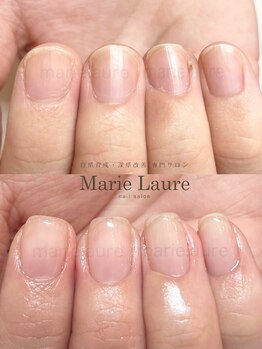 マリーロール 梅田店(Marie Laure)/深爪改善/自爪育成/ネイルケア