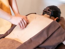 さらのて鍼灸院