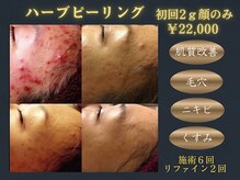 エソール(essor)の雰囲気（ハーブピーリングで肌質改善♪シミケア/美白/ツヤ肌/小顔/毛穴）