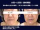 ジュジュ(juju)の写真/【たるみ、ほうれい線、二重あご、頬コケ、毛穴などでお悩みの方に】めざせ自分史上最高のリフトアップ小顔