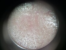 メナードフェイシャルサロン 浜北駅前/エステ後のきれいになった毛穴！