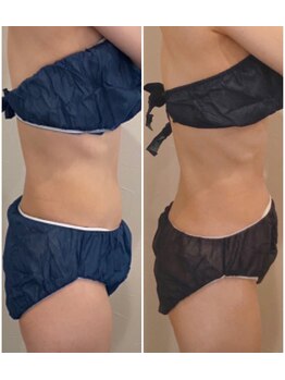 ディアウーマン(Dear Woman)/お腹周りに【浮き輪肉撃退】