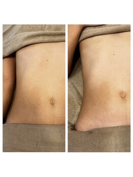 美温(mion)/くびれ