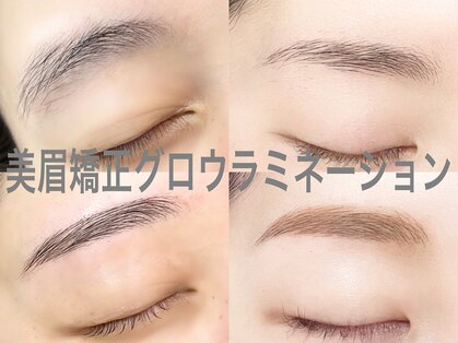 フレックル(freckle)の写真