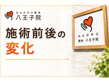 ナオル整体 八王子院(NAORU整体)/施術前後のお身体の変化