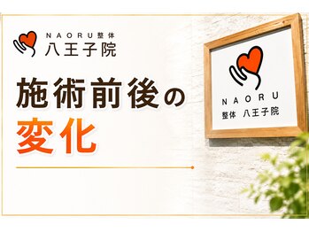 ナオル整体 八王子院(NAORU整体)/施術前後のお身体の変化