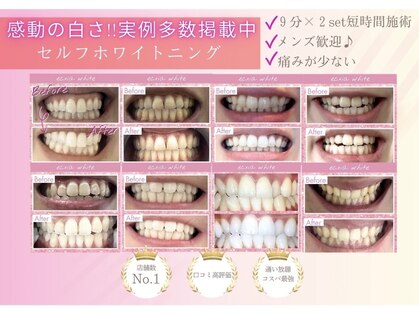 エクシアホワイトニング 岡山駅前店の写真