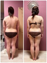 ビマリア(美-MARIA)/美BODY痩身リンパ　30代のお客様