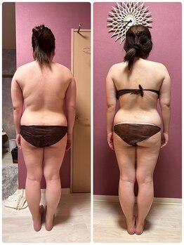 ビマリア(美-MARIA)/美BODY痩身リンパ　30代のお客様