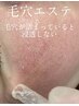 兵庫初！毛穴汚れ&角栓ニョキニョキ♪韓国式３D毛穴洗浄 14300→￥１１０００