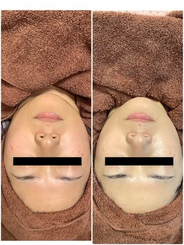 カナウ(kanau)/フェイシャル