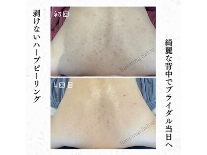 ラヴェンナサロン 札幌店(Ravenna salon)の写真