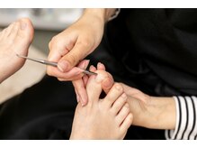 リリ(lili)/巻き爪補正/巻き爪矯正
