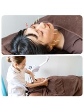 キューサッポロ(SalonQSapporo)/リフトアップ！美容鍼施術