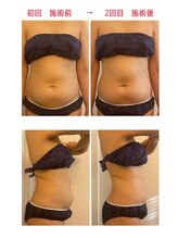 クレール(clair)/