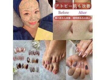 アイビー(The Ivy)