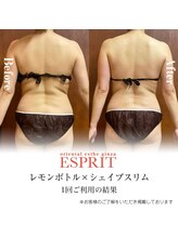 エスプリ 新宿店/驚きの１回での結果レモンボトル