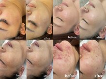 サロン ド シャルモン(salon de sharmant)