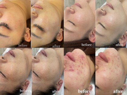 サロン ド シャルモン(salon de sharmant)の写真