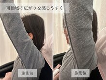 ル キヤ アイスペシャリテ ハービスENT店/【ビフォーアフター】肩こり改善