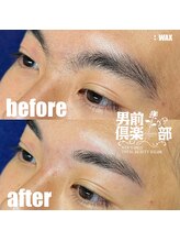 男前倶楽部/脱毛/メンズ脱毛/メンズ専門店