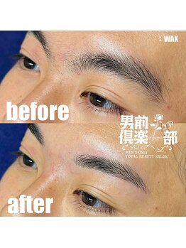 男前倶楽部/脱毛/メンズ脱毛/メンズ専門店