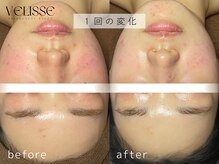 ヴェリス 福岡店(Velisse)/