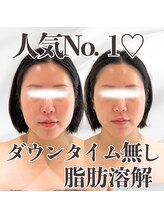 ミタメ 銀座店(MITAME)/ダウンタイムのない脂肪燃解◎
