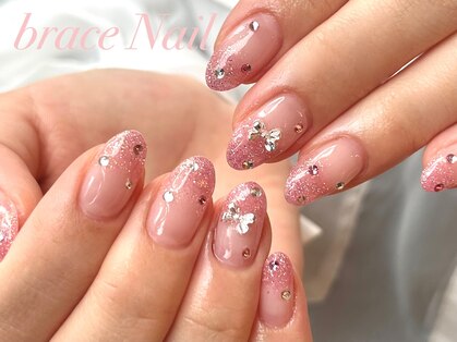 ブレスネイル(brace Nail)の写真