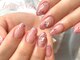 ブレスネイル(brace Nail)の写真