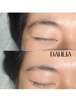 ダリア(Dahlia)/眉毛のワックス脱毛