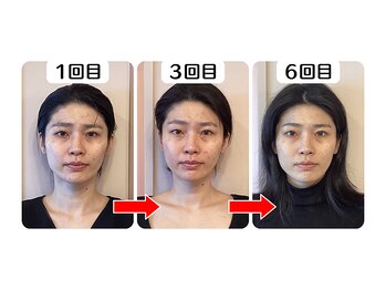 セントラル治療院はりきゅう大心/ビフォーアフター