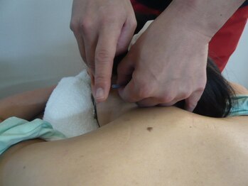 アタック鍼灸院(ATAC鍼灸院)/頸部(首)刺鍼