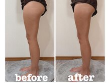 レヌール(LENULE)/アロマリンパマッサージ