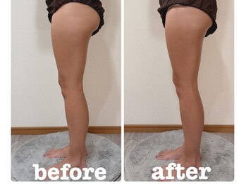 レヌール(LENULE)/アロマリンパマッサージ