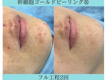 リメイククリニカルビューティー(Remake clinical beauty)/