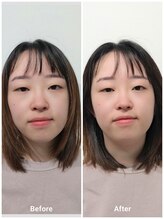 いとう美容整体/☆小顔矯正のBefore After☆