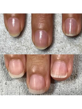 ミル(mill)/自爪育成