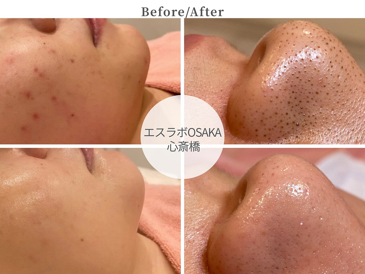 エスラボ オオサカ 心斎橋｜ホットペッパービューティー