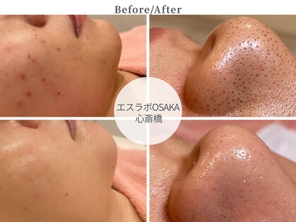 エスラボ オオサカ 心斎橋の写真