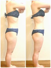 リナル 武蔵小杉店/150分☆痩身マシン＋全身リンパ