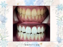 ホワイト つくば店(WHITE)/継続の美容