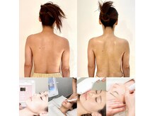 ミーティット(Meetite)