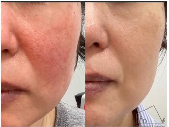 我楽 南浦和/ビスポーク美肌フェイシャル