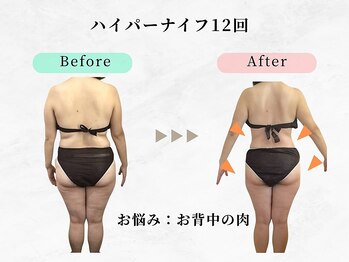 美容整体ウェリナ 名駅院/.【ダイエットbefore→after】