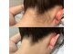 ミニョン(mignon)の写真/最新LED脱毛機で全身脱毛!お好きな箇所を選べて都度払いOK♪理想の肌へ導くエステ体験を!★