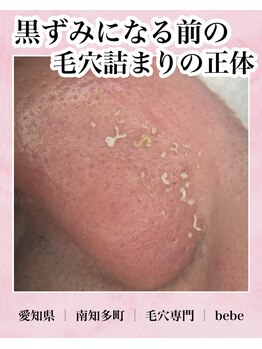 ベベ(bebe)/毛穴の中身