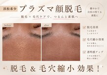 アール(ar.)